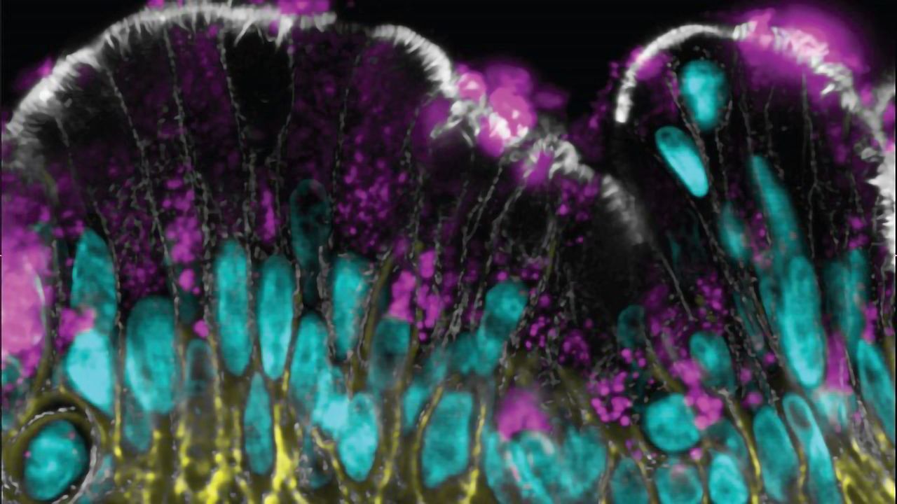 Investigating the Human Intestinal Mucus Barrier Up-close and Personal