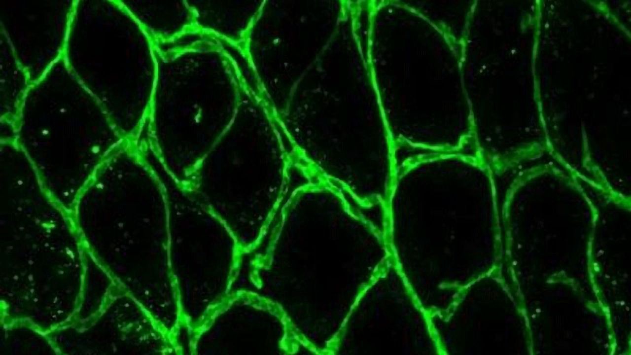 Targeting a Protease To Treat Inflammatory Bowel Disease
