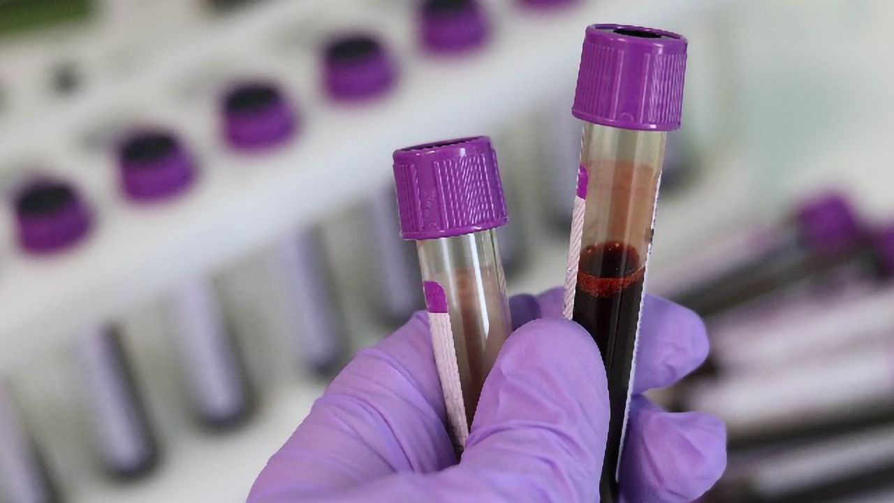 A "Liquid Health Check" Could Help Predict Disease Risk