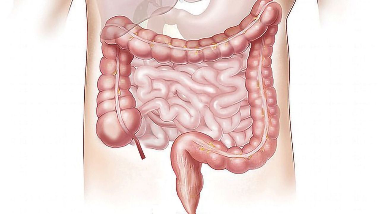Drug Decreases Gut “Leakiness” Linked to Ulcerative Colitis