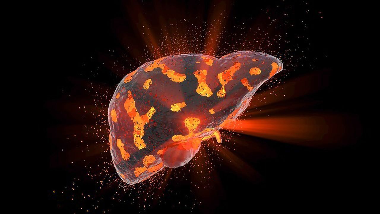 3D Model of Human Liver for Better Diagnosis