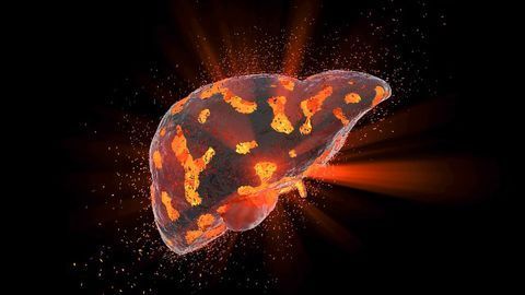 3D Model of Human Liver for Better Diagnosis