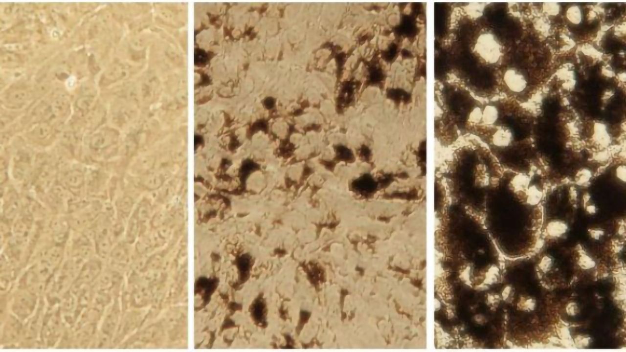 New Cell Models Open Up Ocular Drug Discovery
