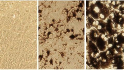 New Cell Models Open Up Ocular Drug Discovery