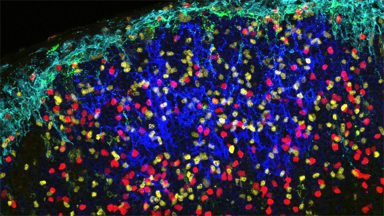 Immune Cell Acts as Shuttle To Spread HIV Around the Body