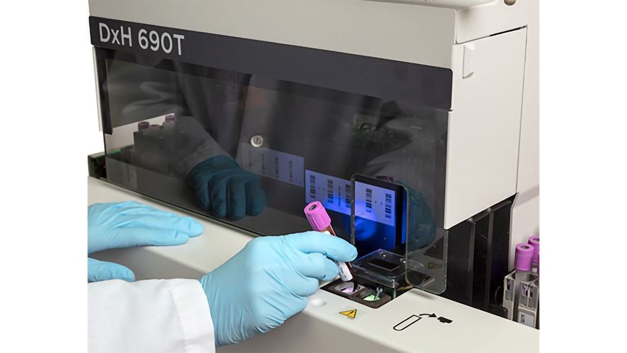 Mid-size Lab Haematology Analyzer Has Large Lab Capabilities