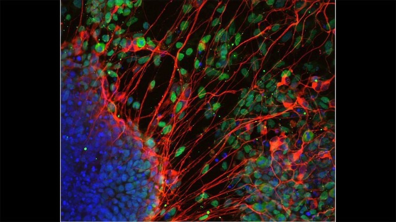 How Do Stem Cells Decide Their Identity?