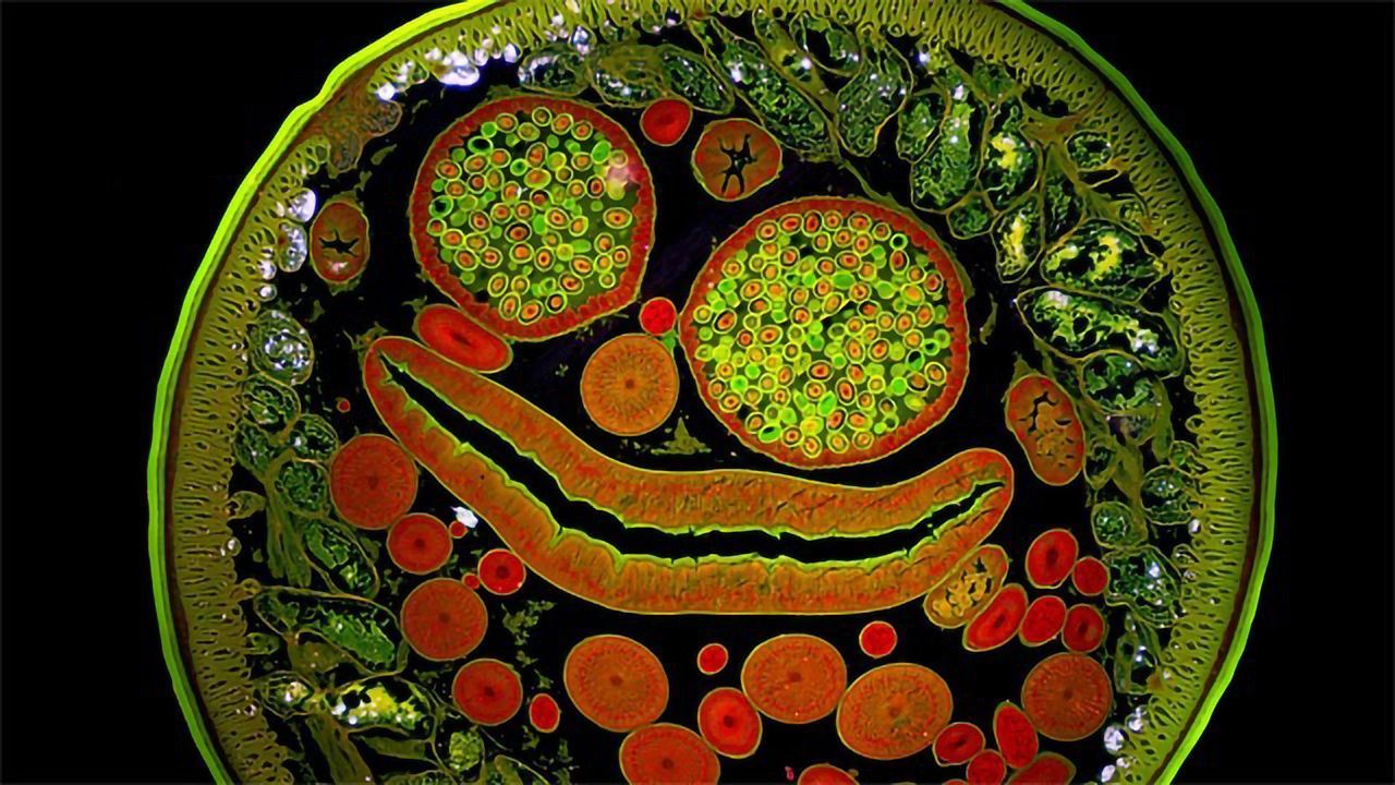 The Very Happy Roundworm