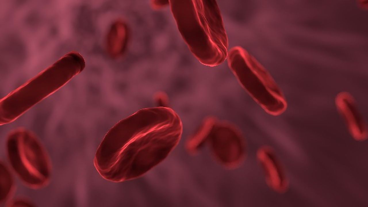 Focused Ultrasound Could Boost Brain Blood Flow for Alzheimer's Treatment