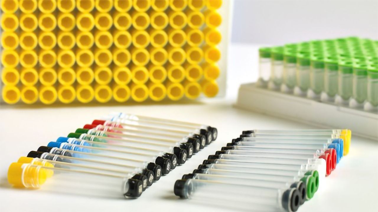 Tracking Samples to Improve Food Safety
