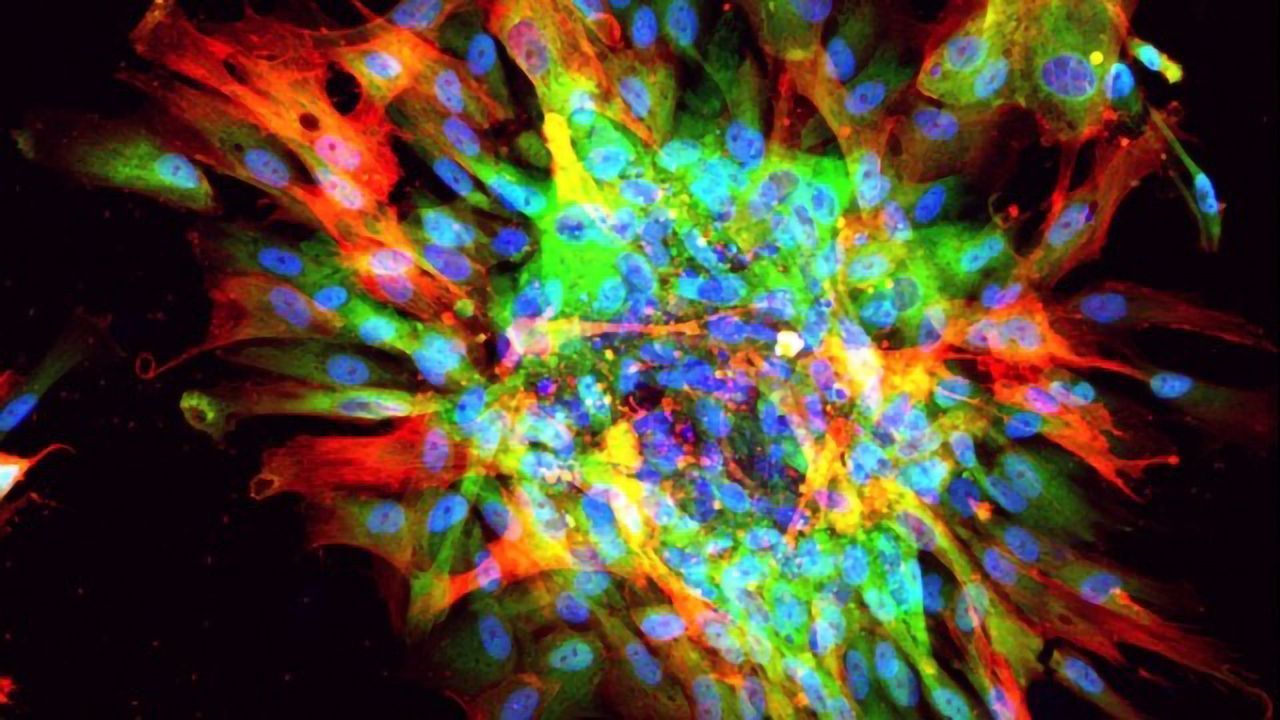 “Scar in a Dish” Model Mimics Fibrosis