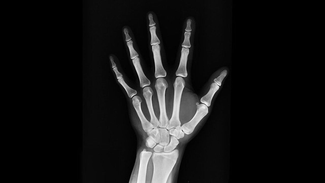 New Mechanism of Bone Maintenance and Repair Discovered