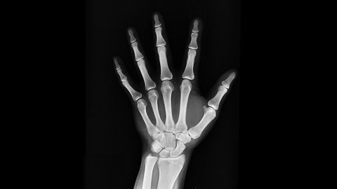 New Mechanism of Bone Maintenance and Repair Discovered
