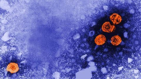 Strategic Plan To Cure Hepatitis B in the Making