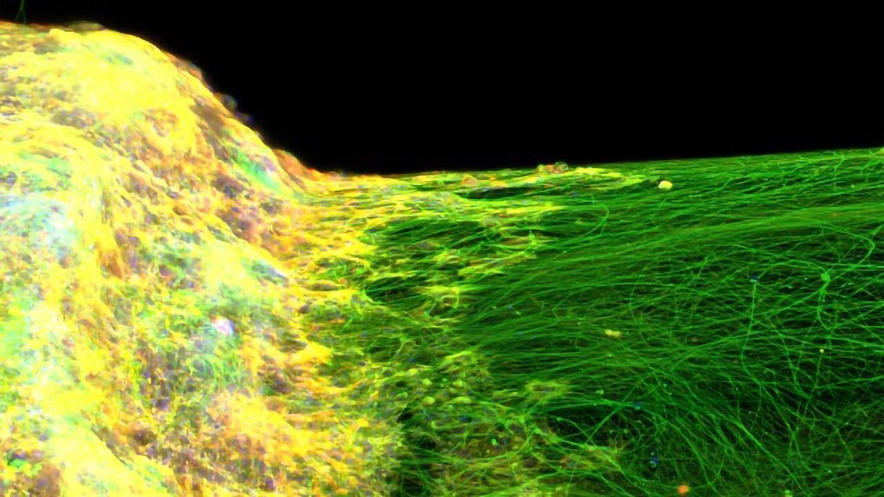 First-of-a-Kind In Vitro 3D Neural Tissue Model Developed