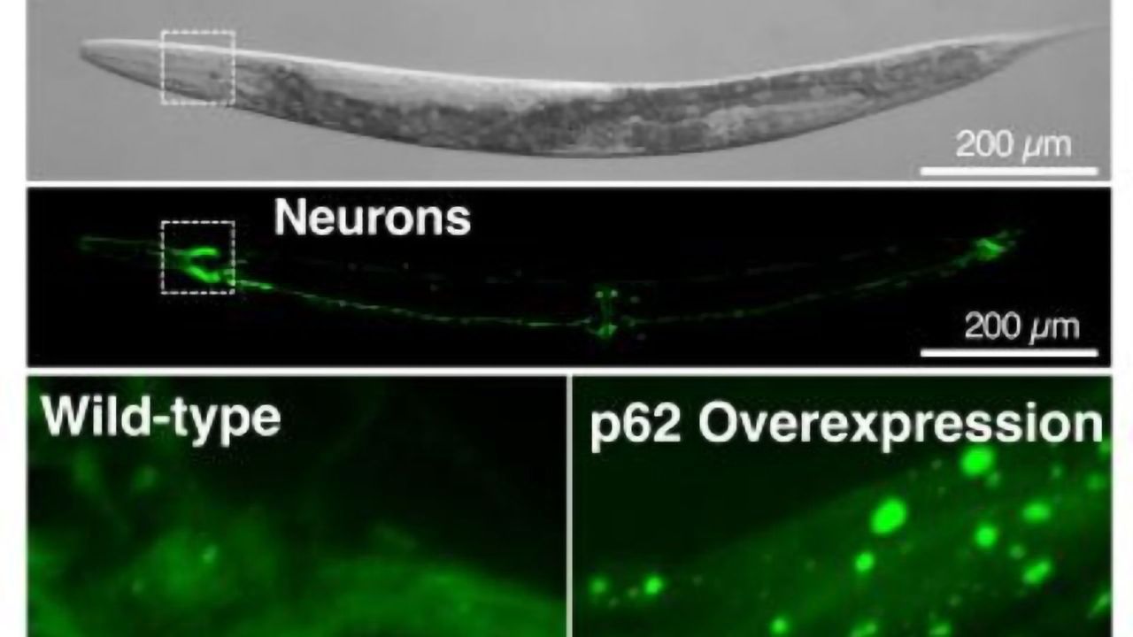 The Secret to a Long Life? For Worms, a Cellular Recycling Protein Is Key