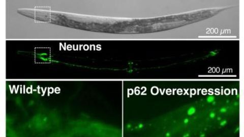 The Secret to a Long Life? For Worms, a Cellular Recycling Protein Is Key