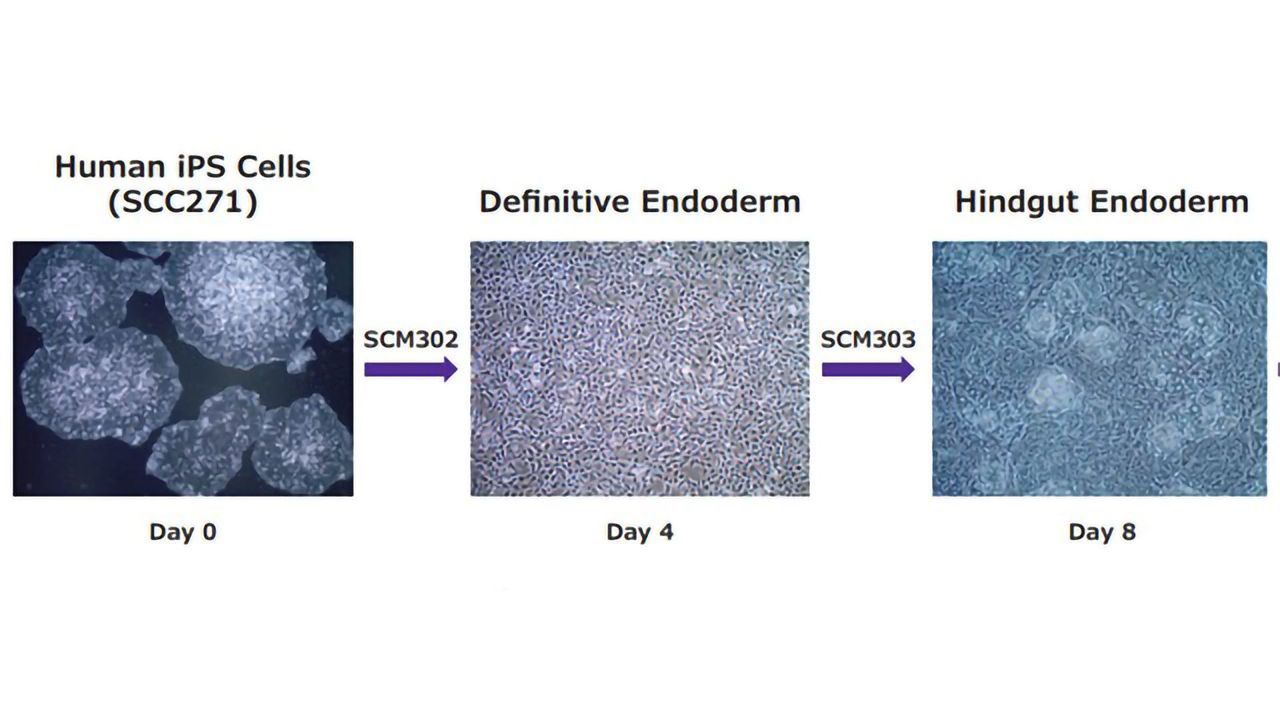 In Vitro Differentiation of Human iPS Cells into Colon Organoids in Serum-free Cell Culture Conditions