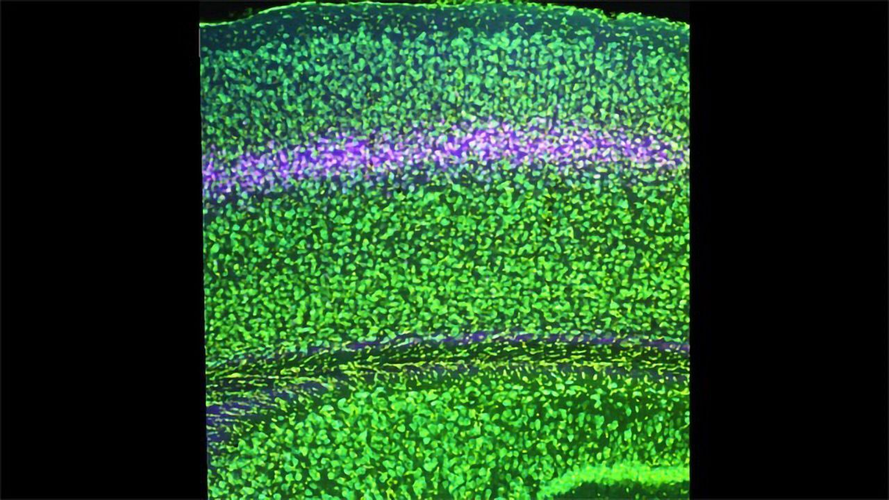 Exploring Vision in the Brain "Pancake Stack"