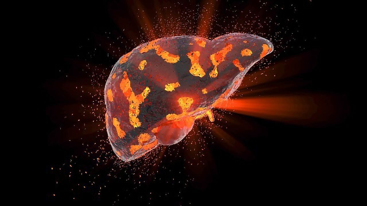 Behind the Scenes of MRI-based Liver Disease Diagnostics