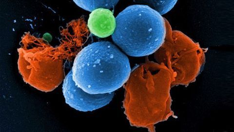 Team Modify Approved Cancer Drug To Develop Antibiotic