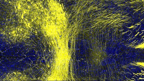 Mutated Neuron Antennae Can Lead to Neurodevelopmental Disorders