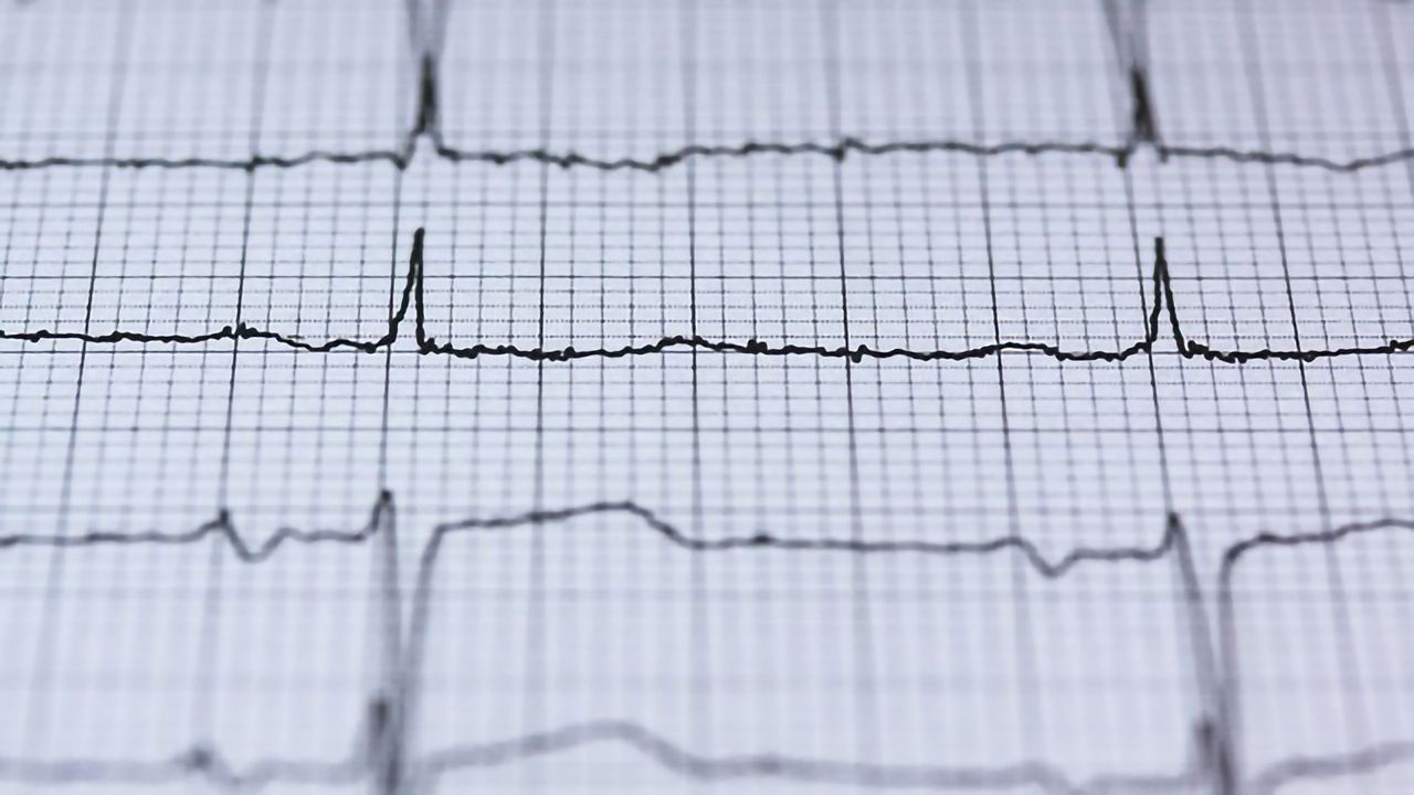 Scientists Take Stem Cells and Convert Them to Heart Pacemaker Cells