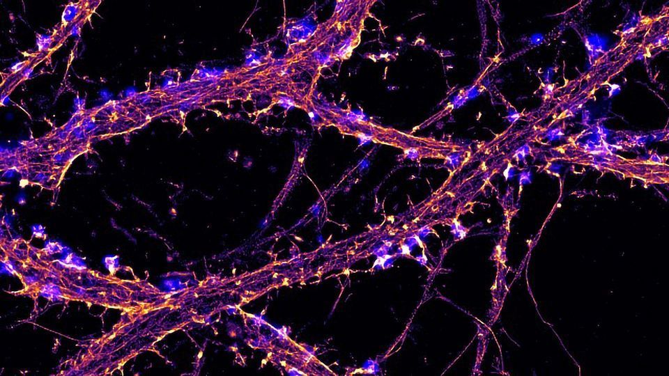 What is Super-Resolution Microscopy? STED, SIM and STORM Explained content piece image