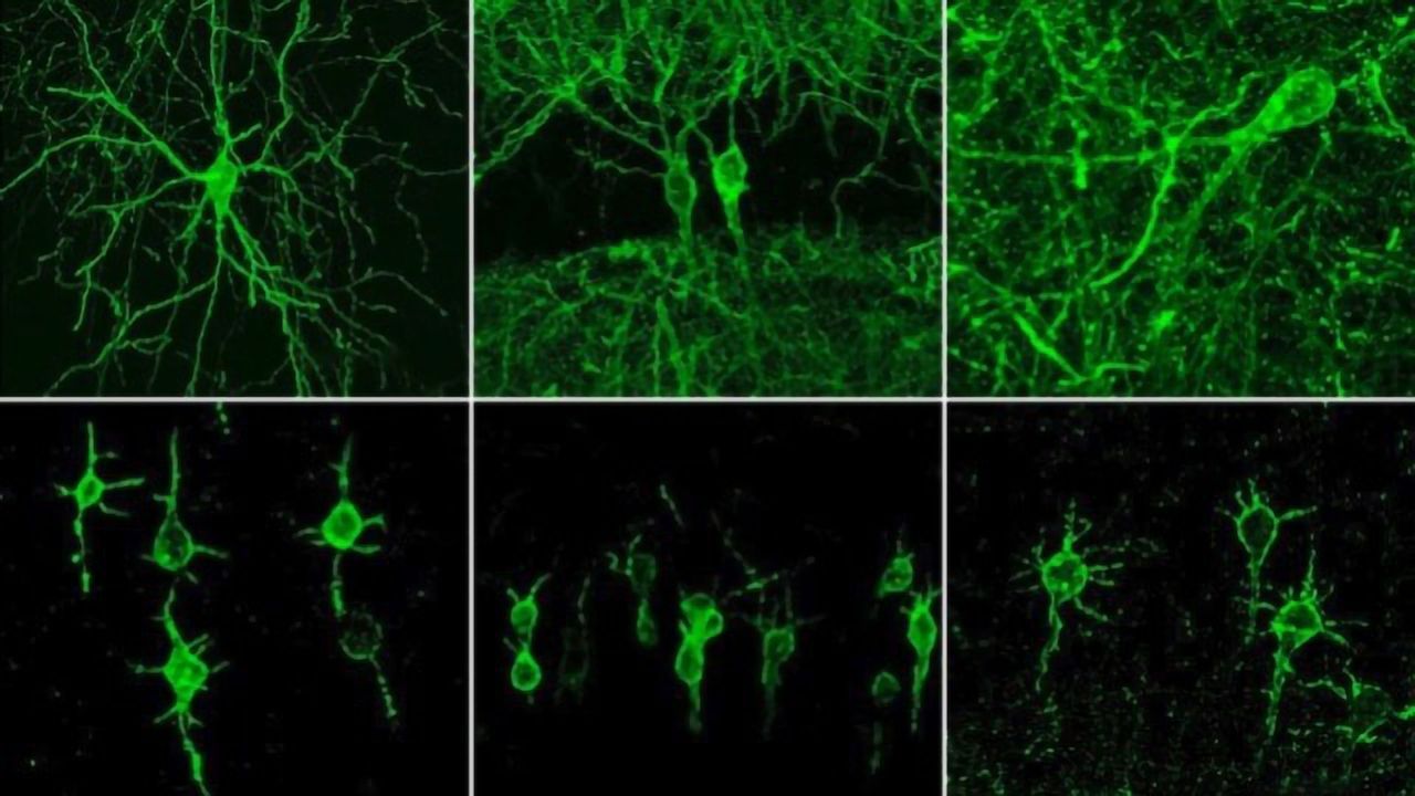 New Fluorescent Probe Could Allow Scientists to Watch Circuits Within the Brain