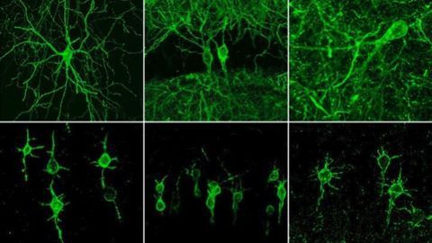 New Fluorescent Probe Could Allow Scientists to Watch Circuits Within the Brain