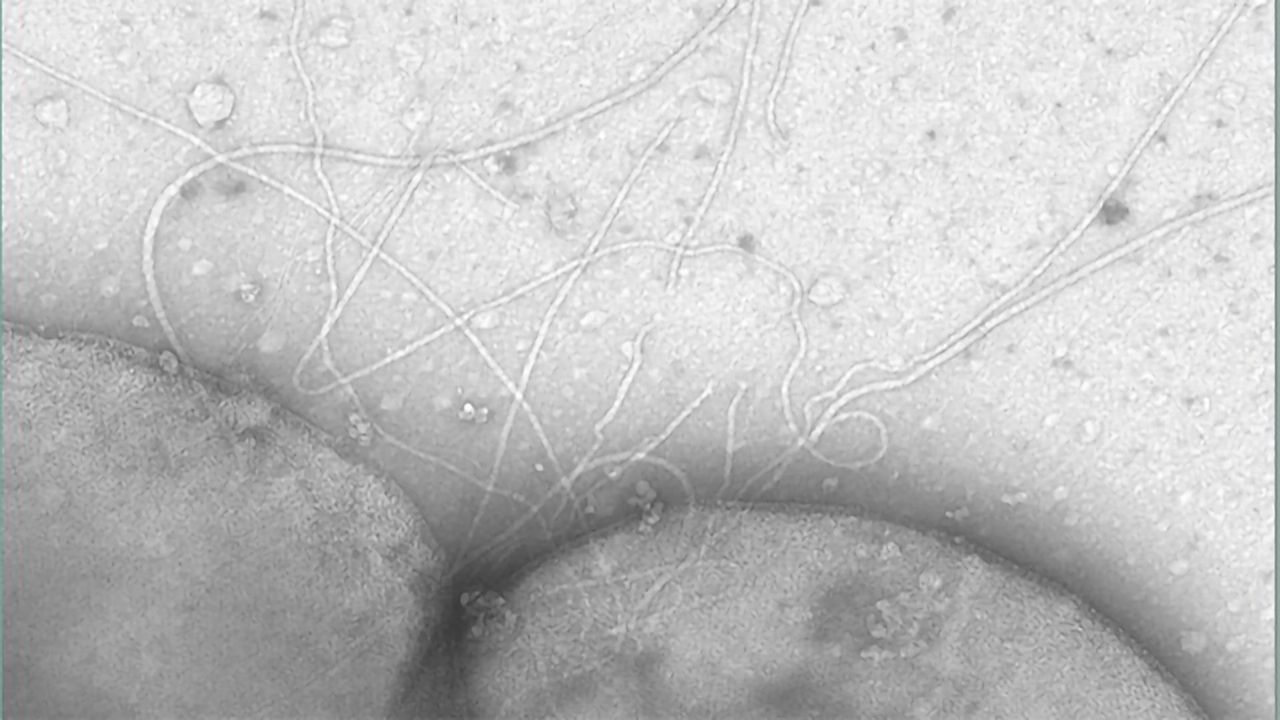 How Cells Get Moving