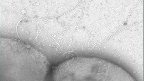 How Cells Get Moving