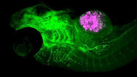 Zebrafish “Avatars” Could Help Determine Who Should Receive Radiotherapy