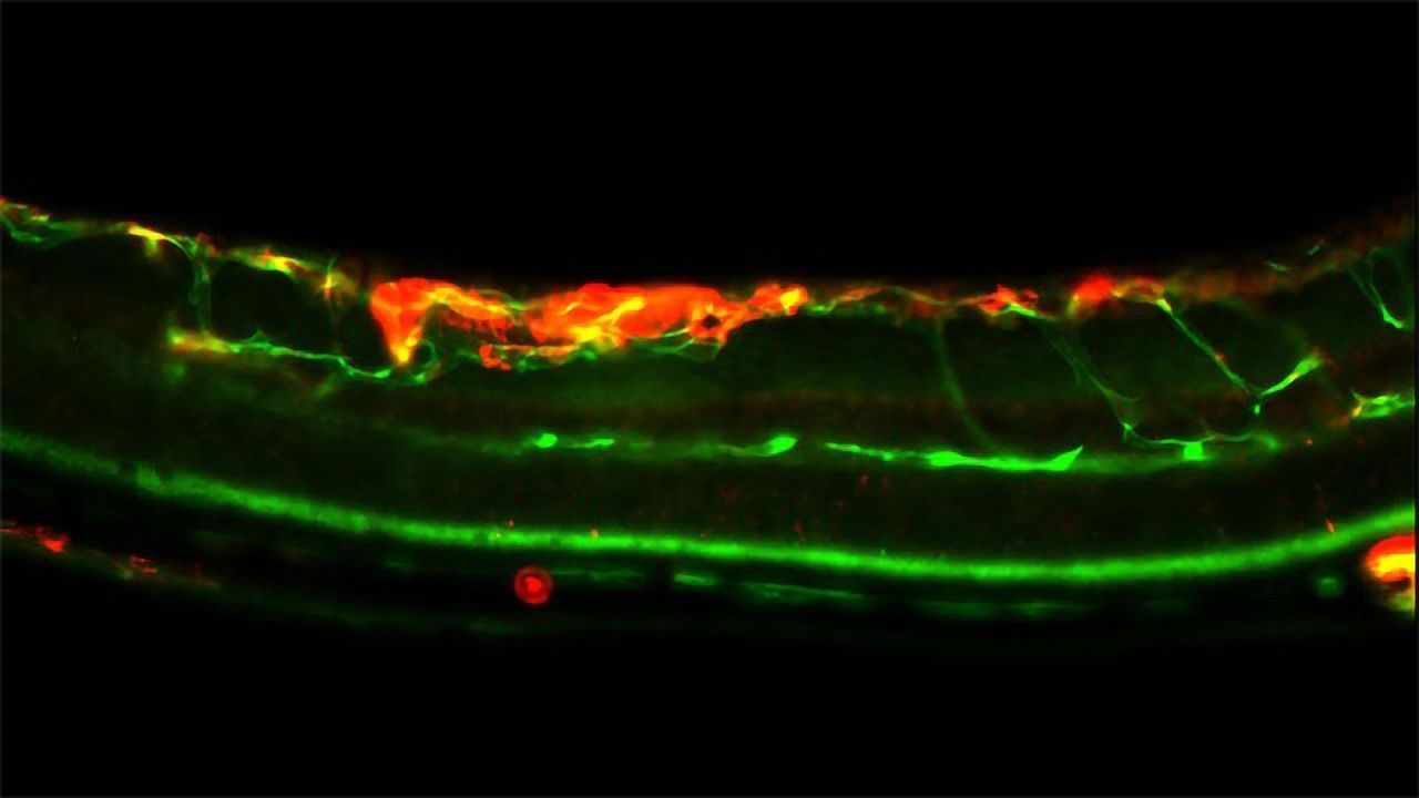 A Novel Genetic Signature For Predicting Breast Cancer