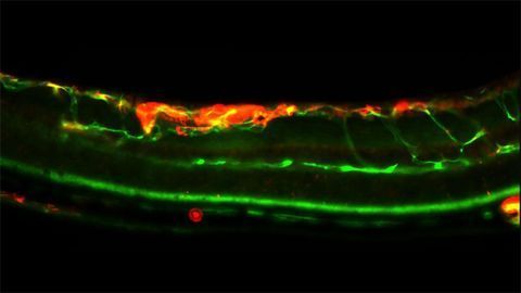 A Novel Genetic Signature For Predicting Breast Cancer