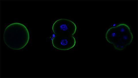 Glycine Receptors Aren't Just Important for the Brain