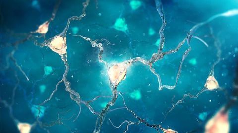 Drug Reduces Seizures in Patients With Dravet