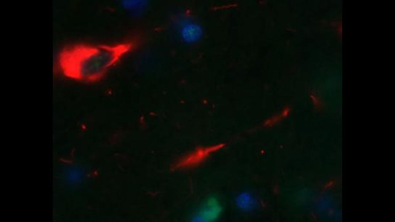 Can We Protect the Brain From Tau?