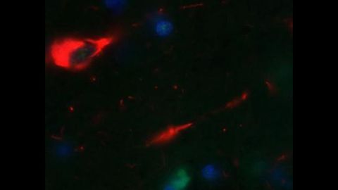 Can We Protect the Brain From Tau?