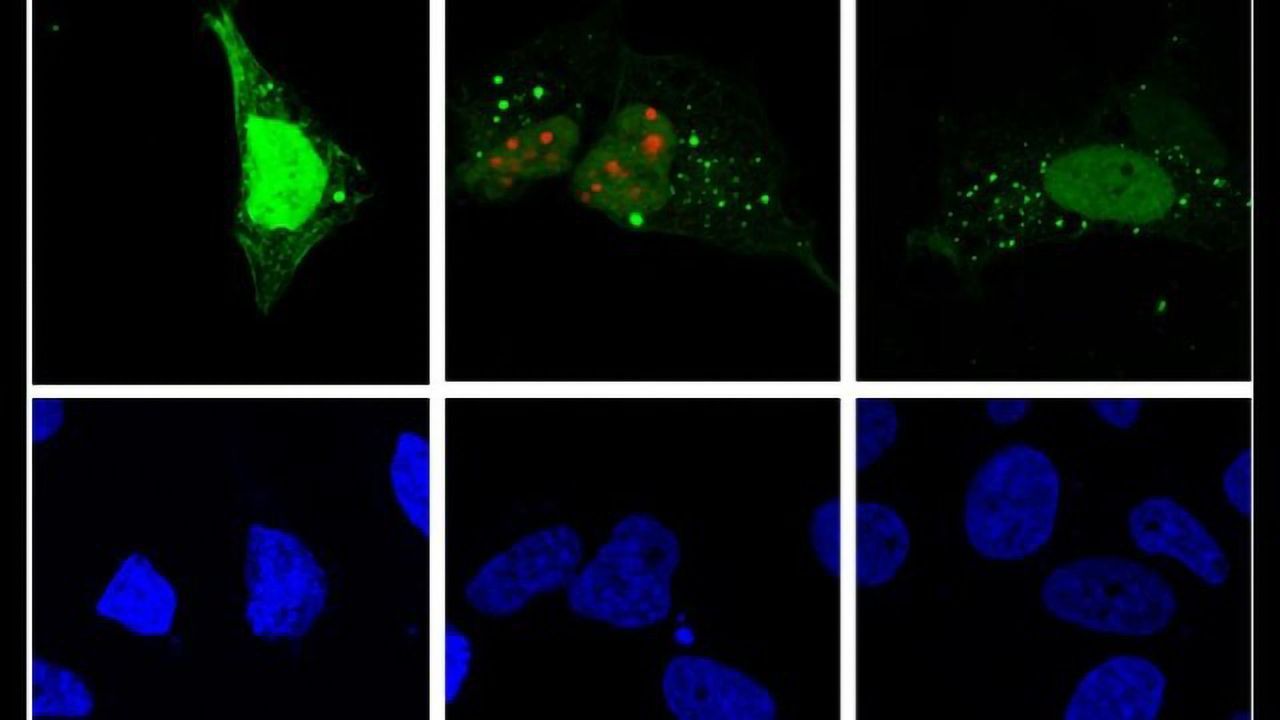 Mystery of Hepatitis D Life Cycle Revealed