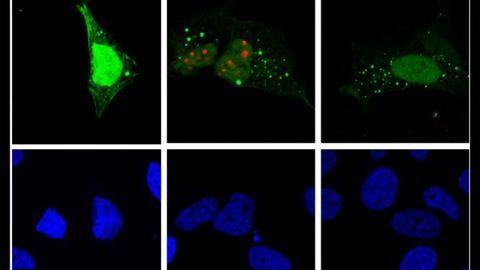 Mystery of Hepatitis D Life Cycle Revealed