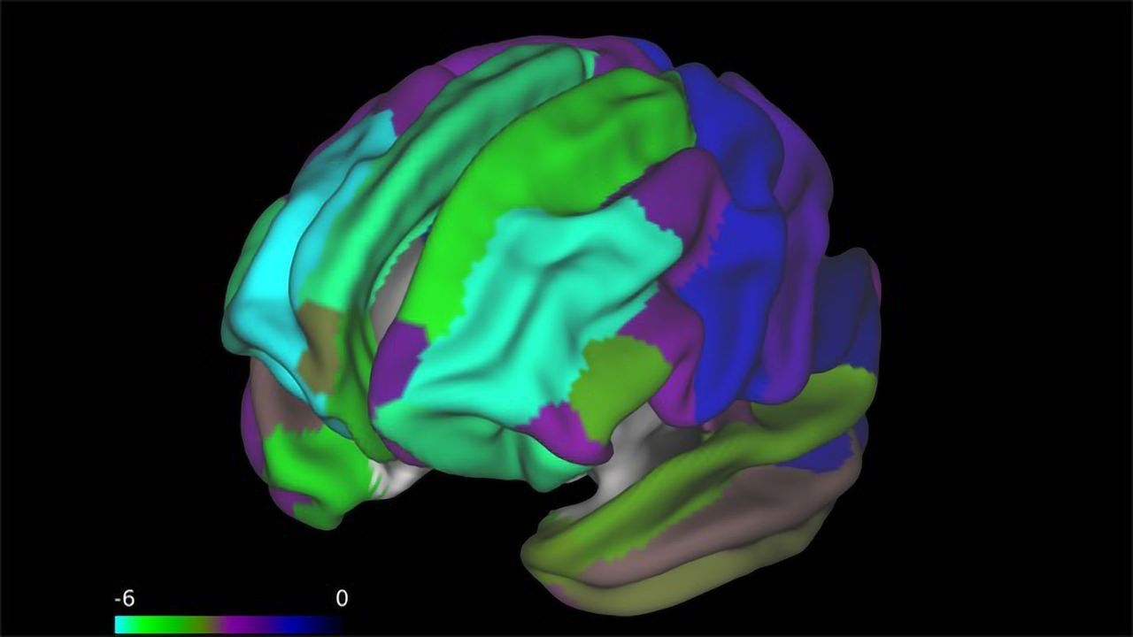 Obesity Could Affect Brain Development in Children