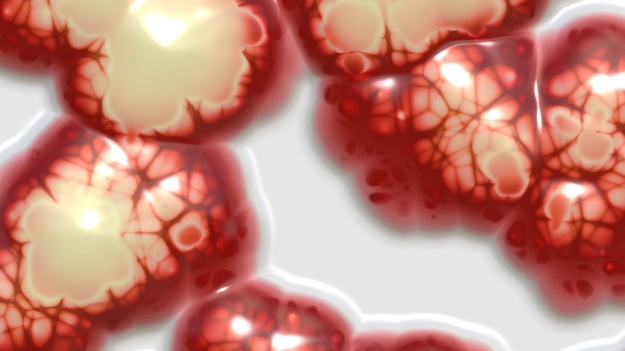 Brain Tumor Organoids May be Key to Time-sensitive Treatments for Glioblastomas