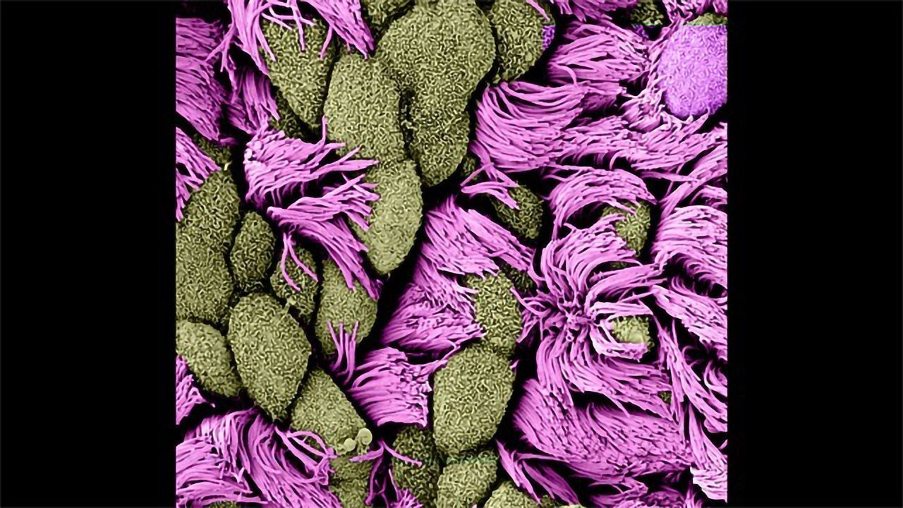 Surface of a Multiciliated Cell