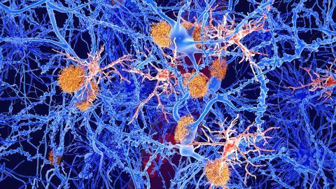 A Stroke of Bad Luck: The 2019 Paget Lecture by Professor Dame Nancy Rothwell