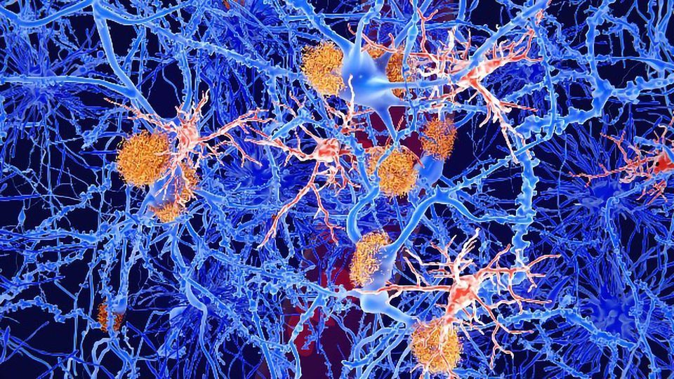 A Stroke of Bad Luck: The 2019 Paget Lecture by Professor Dame Nancy Rothwell content piece image