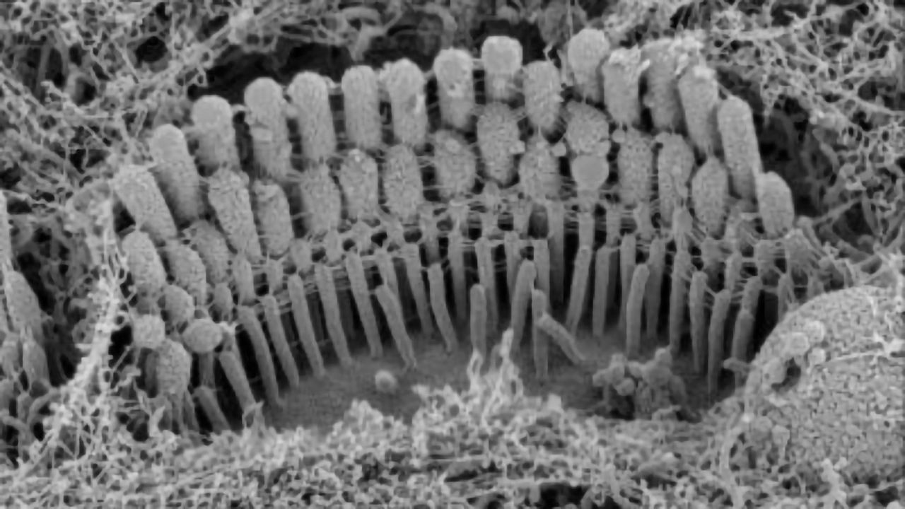 Hearing Develops in Tandem With Form and Function