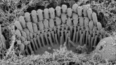 Hearing Develops in Tandem With Form and Function