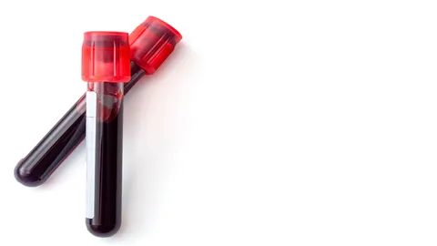 Two blood collection tubes containing blood samples on a white background.