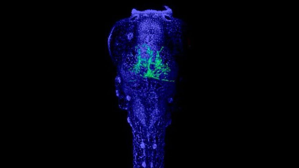 Algorithm Identifies New Treatment for Neuroblastoma content piece image